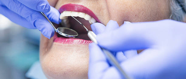 Best Dental Abscess Treatment in Glencoe, FL